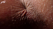 Anus closeup